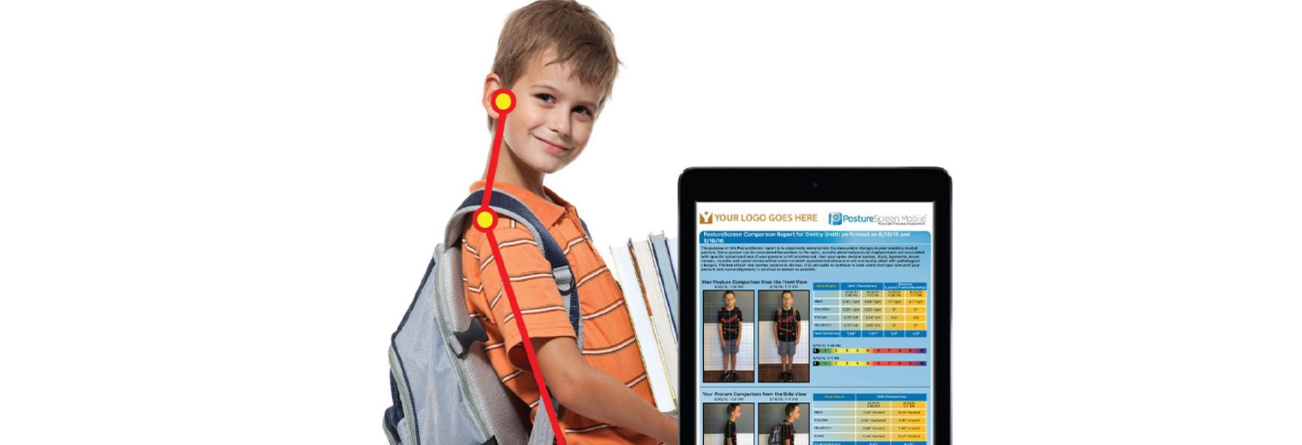 Reeducacao Postural Global